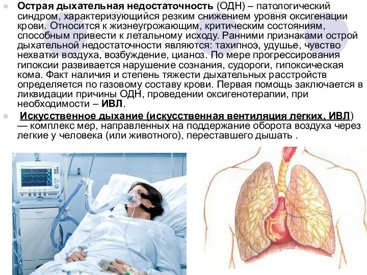 Острая дыхательная недостаточность (ОДН) – патологический синдром, характеризующийся резким снижением уровня