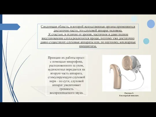 Следующая область, в которой искусственные органы применяются достаточно часто, это слуховой