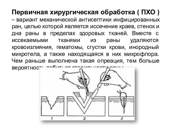 Первичная хирургическая обработка ( ПХО ) – вариант механической антисептики инфицированных