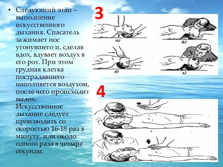 Следующий этап – выполнение искусственного дыхания. Спасатель зажимает нос утонувшего и,