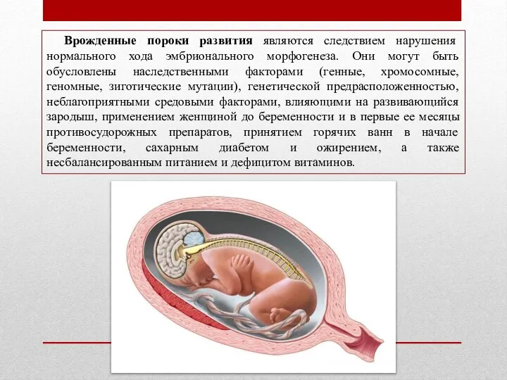 Врожденные пороки развития являются следствием нарушения нормального хода эмбрионального морфогенеза. Они