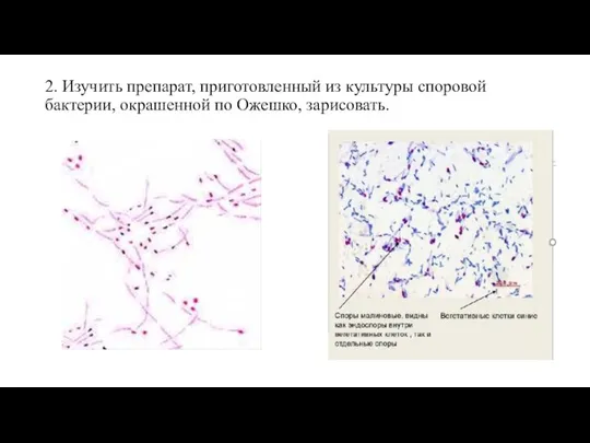 2. Изучить препарат, приготовленный из культуры споровой бактерии, окрашенной по Ожешко, зарисовать.