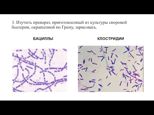 3. Изучить препарат, приготовленный из культуры споровой бактерии, окрашенной по Граму, зарисовать. БАЦИЛЛЫ КЛОСТРИДИИ