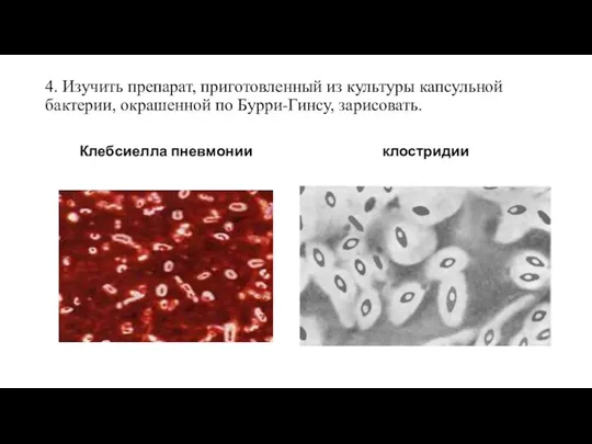 4. Изучить препарат, приготовленный из культуры капсульной бактерии, окрашенной по Бурри-Гинсу, зарисовать. Клебсиелла пневмонии клостридии