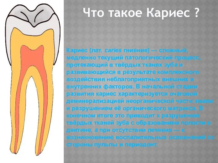 Что такое Кариес ? Кариес (лат. caries гниение) — сложный, медленно