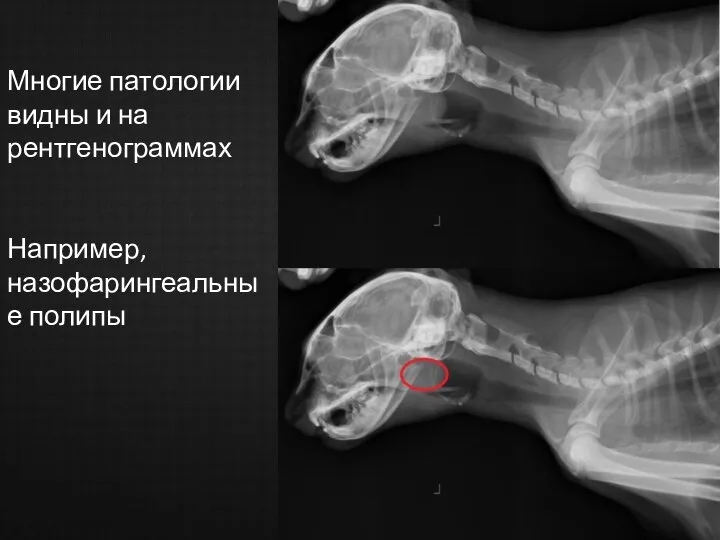 Многие патологии видны и на рентгенограммах Например, назофарингеальные полипы