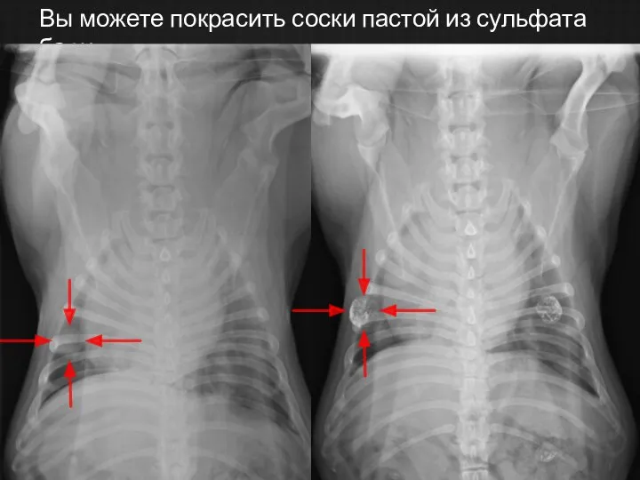 Вы можете покрасить соски пастой из сульфата бария