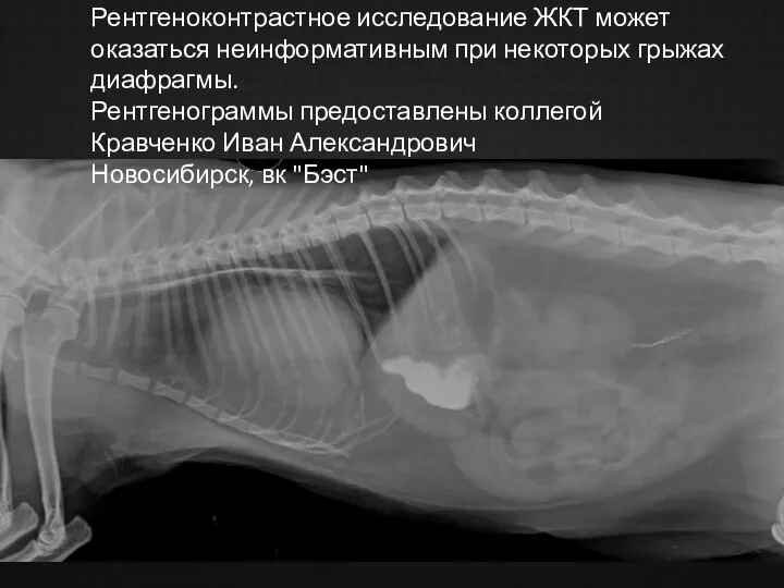 Рентгеноконтрастное исследование ЖКТ может оказаться неинформативным при некоторых грыжах диафрагмы. Рентгенограммы