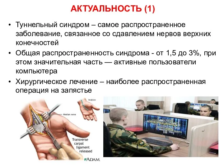 АКТУАЛЬНОСТЬ (1) Туннельный синдром – самое распространенное заболевание, связанное со сдавлением