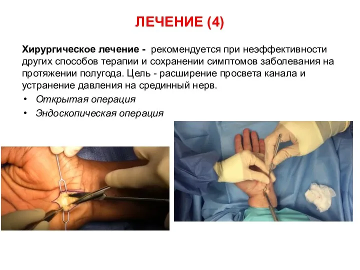 Хирургическое лечение - рекомендуется при неэффективности других способов терапии и сохранении