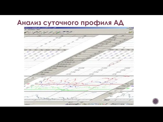 Анализ суточного профиля АД