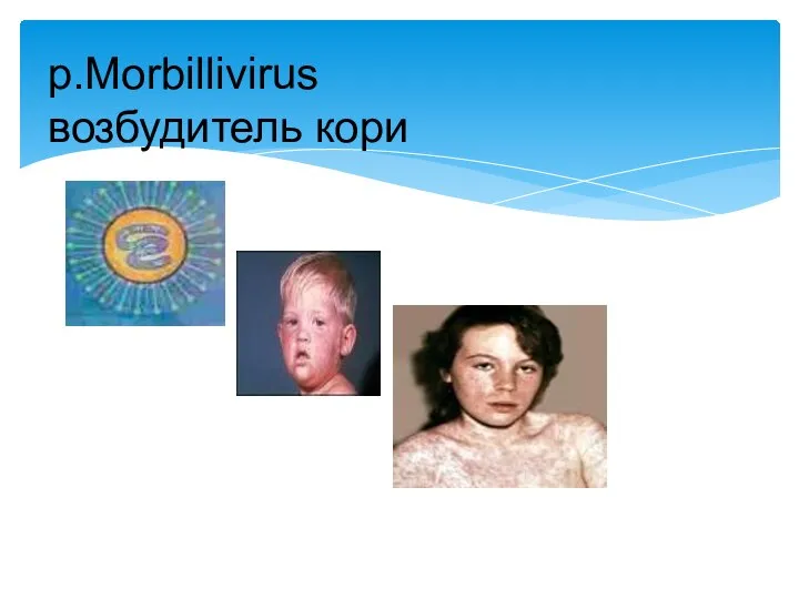 p.Morbillivirus возбудитель кори