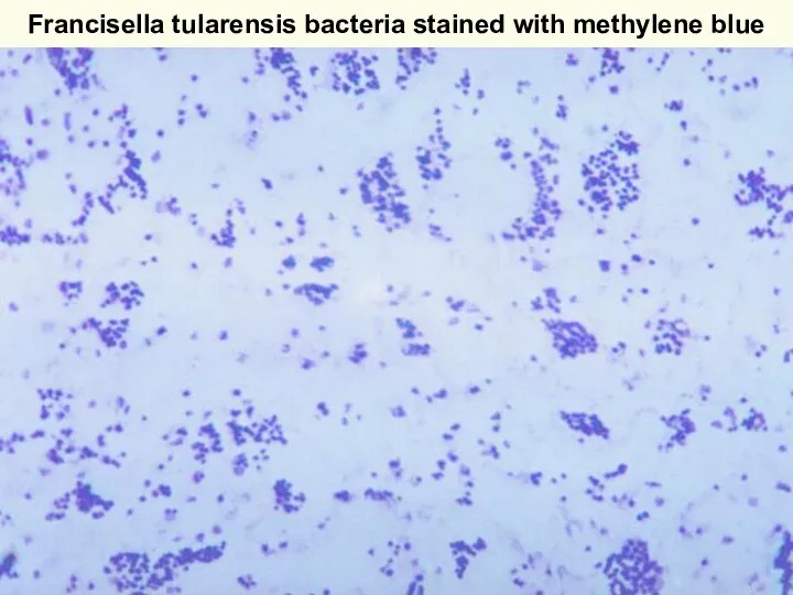 Francisella tularensis bacteria stained with methylene blue