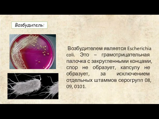 Возбудитель: Возбудителем является Escherichia coli. Это – грамотрицательная палочка с закругленными