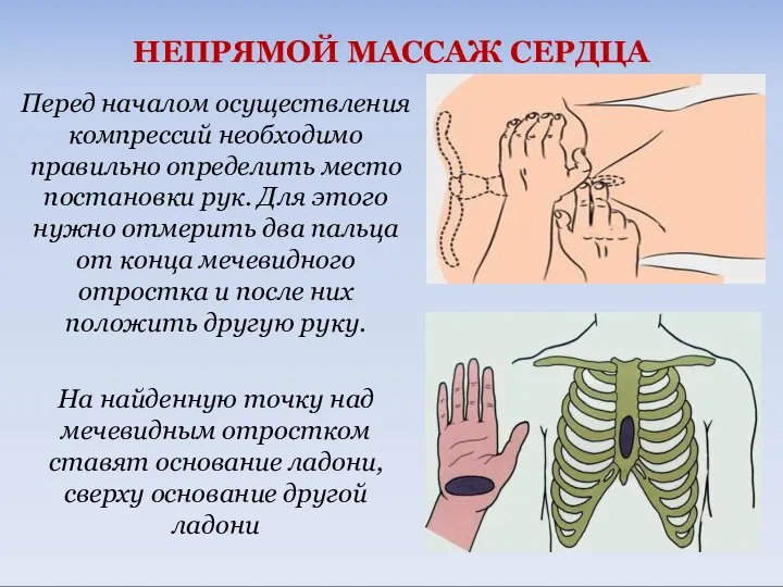 НЕПРЯМОЙ МАССАЖ СЕРДЦА Перед началом осуществления компрессий необходимо правильно определить место