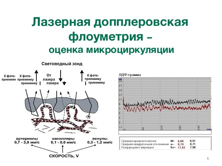 Лазерная допплеровская флоуметрия – оценка микроциркуляции