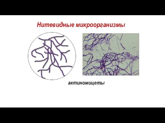 Нитевидные микроорганизмы актиномицеты