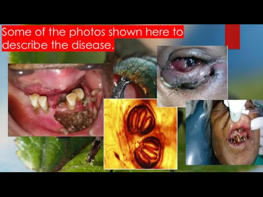 Some of the photos shown here to describe the disease.