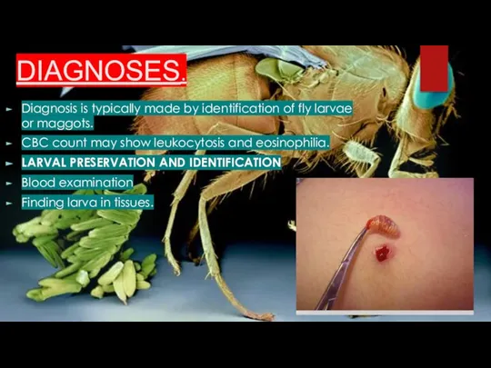 DIAGNOSES. Diagnosis is typically made by identification of fly larvae or