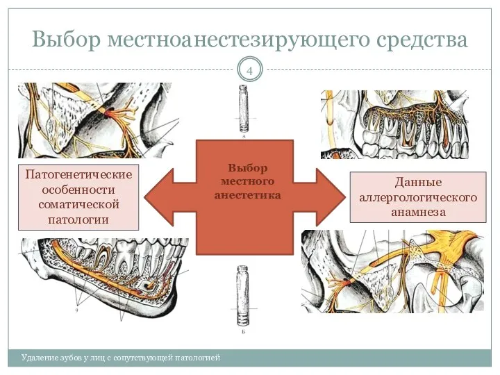 Выбор местноанестезирующего средства Удаление зубов у лиц с сопутствующей патологией Выбор