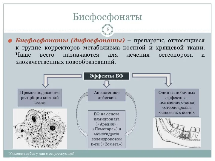 Бисфосфонаты Удаление зубов у лиц с сопутствующей патологией Бисфосфонаты (дифосфонаты) –