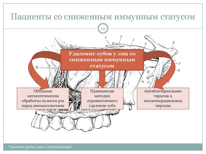 Пациенты со сниженным иммунным статусом Удаление зубов у лиц с сопутствующей