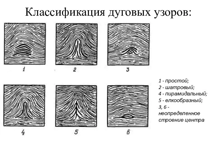 Классификация дуговых узоров: 1 - простой; 2 - шатровый; 4 -