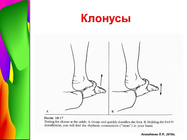 Клонусы Ахмадеева Л.Р., 2018г.