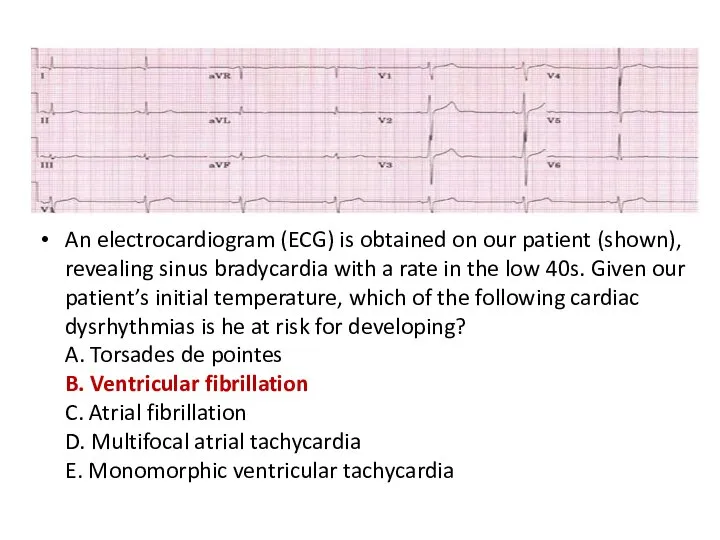 An electrocardiogram (ECG) is obtained on our patient (shown), revealing sinus
