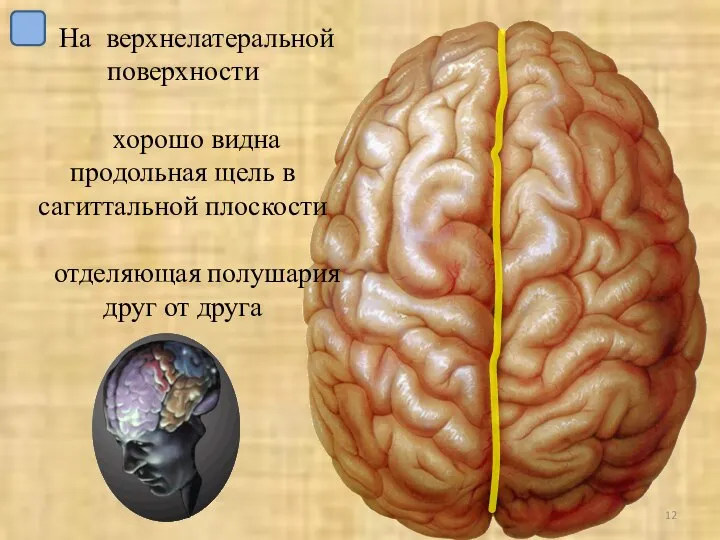 На верхнелатеральной поверхности хорошо видна продольная щель в сагиттальной плоскости отделяющая полушария друг от друга