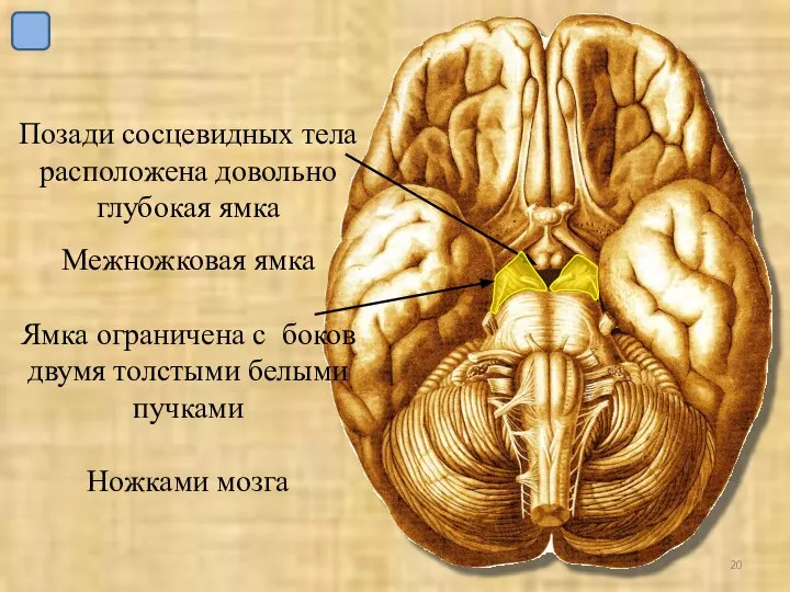 Позади сосцевидных тела расположена довольно глубокая ямка Межножковая ямка Ямка ограничена