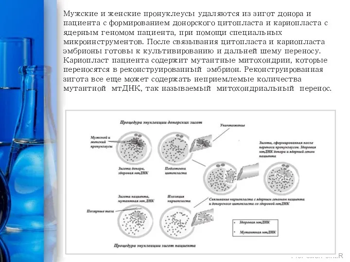 Мужские и женские пронуклеусы удаляются из зигот донора и пациента с