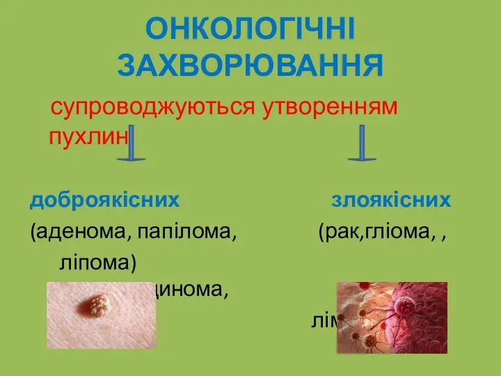 ОНКОЛОГІЧНІ ЗАХВОРЮВАННЯ супроводжуються утворенням пухлин доброякісних злоякісних (аденома, папілома, (рак,гліома, , ліпома) аденокарцинома, лімфома)