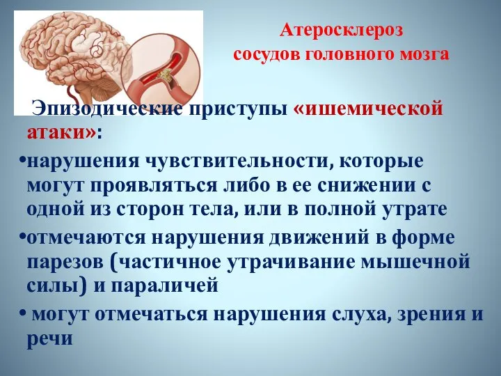 Атеросклероз сосудов головного мозга Эпизодические приступы «ишемической атаки»: нарушения чувствительности, которые