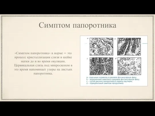 Симптом папоротника «Симптом папоротника» в норме – это процесс кристаллизации слизи