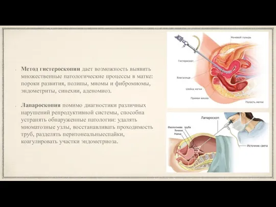 Метод гистероскопии дает возможность выявить множественные патологические процессы в матке: пороки