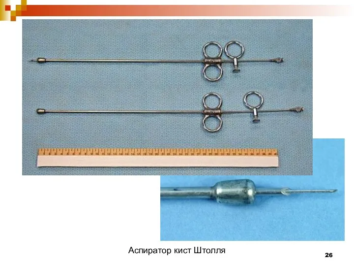 Аспиратор кист Штолля