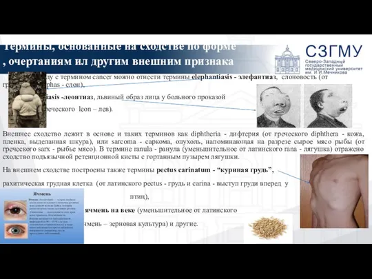 Термины, основанные на сходстве по форме, очертаниям ил другим внешним признакам: