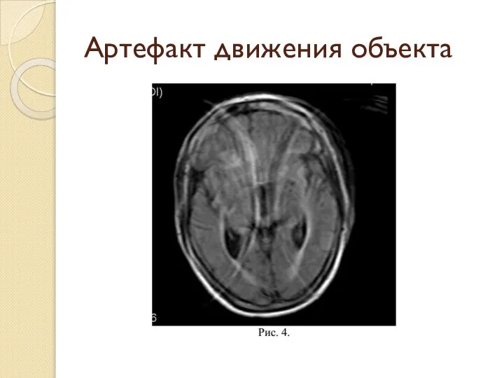 Артефакт движения объекта