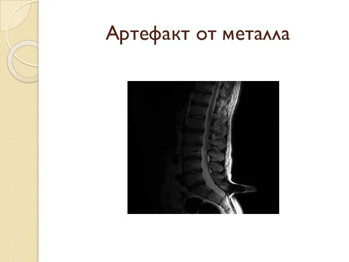 Артефакт от металла