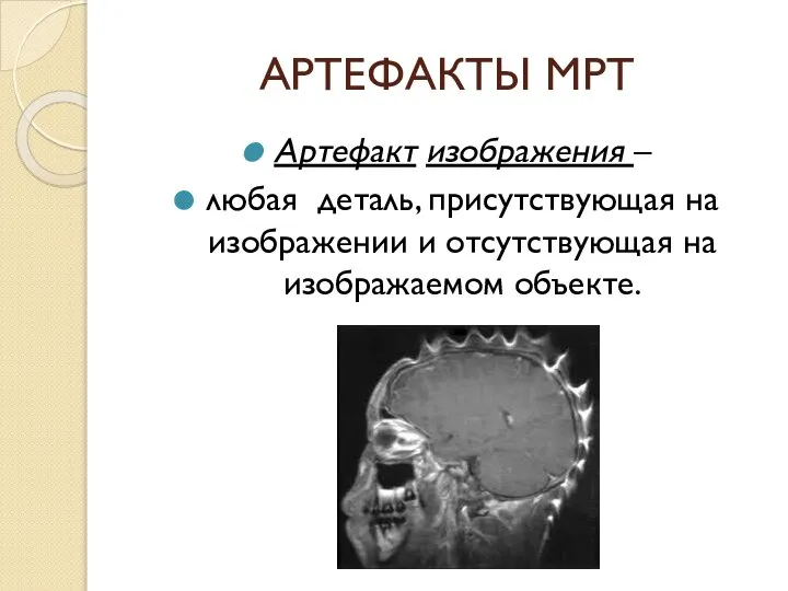 АРТЕФАКТЫ МРТ Артефакт изображения – любая деталь, присутствующая на изображении и отсутствующая на изображаемом объекте.