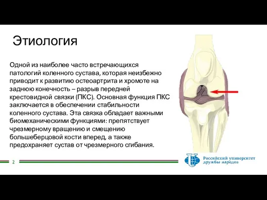 Этиология Одной из наиболее часто встречающихся патологий коленного сустава, которая неизбежно