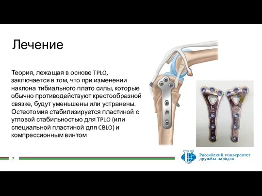 Лечение Теория, лежащая в основе TPLO, заключается в том, что при