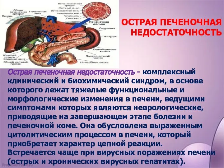 Острая печеночная недостаточность - комплексный клинический и биохимический синдром, в основе