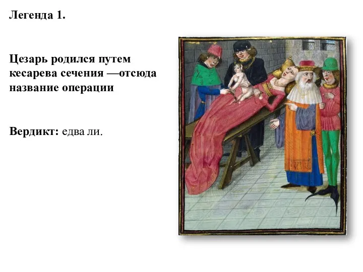 Легенда 1. Цезарь родился путем кесарева сечения —отсюда название операции Вердикт: едва ли.