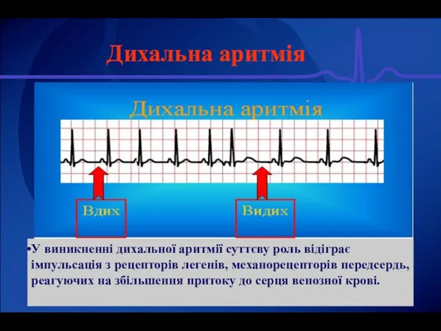 Дихальна аритмія У виникненні дихальної аритмії суттєву роль відіграє імпульсація з