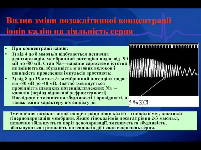 Вплив зміни позаклітинної концентрації іонів калію на діяльність серця При концентрації