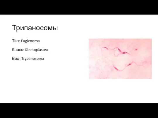 Трипаносомы Тип: Euglenozoa Класс: Kinetoplastea Вид: Trypanosoma