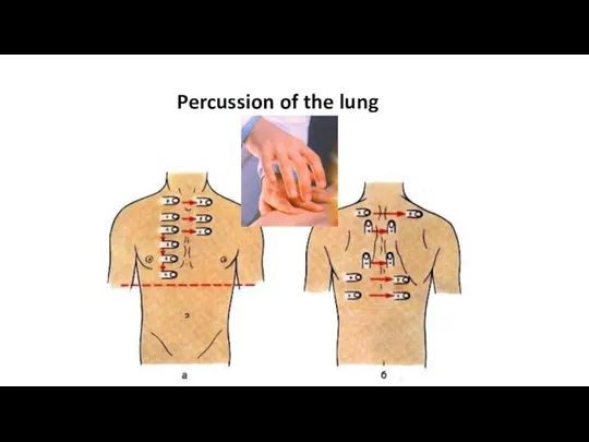 Percussion of the lung