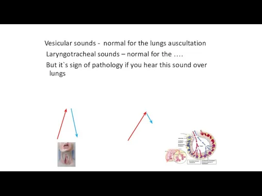 Vesicular sounds - normal for the lungs auscultation Laryngotracheal sounds –